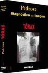 TORAX.DIAGNOSTICO POR IMAGEN/1 -CARTONE